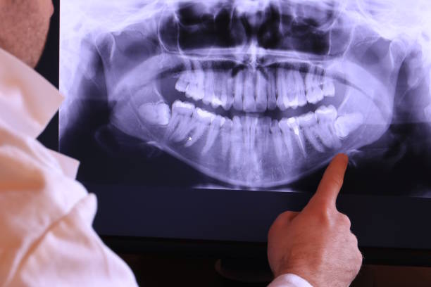 Best Emergency Dental Services for Seniors in Waycross, GA