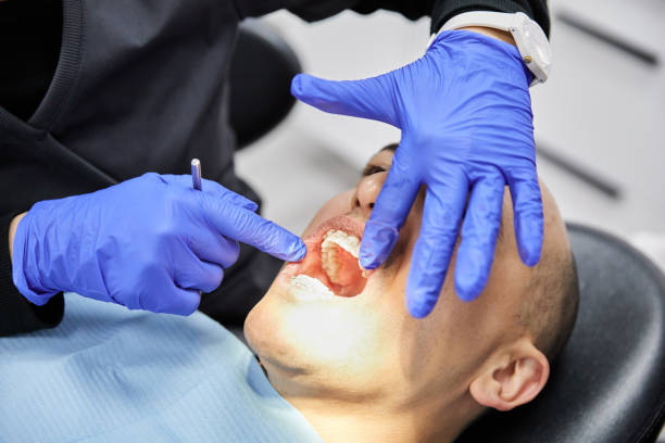 Best Emergency Root Canal Treatment in Waycross, GA